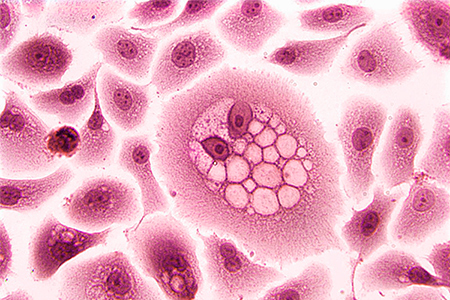 squamous epithelial cells