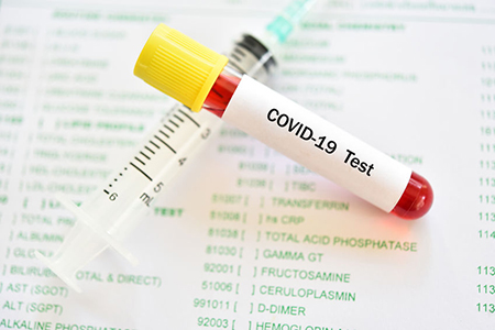 Test tube with blood sample for COVID-19 test