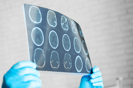 Hands of a doctor holding head mri scan